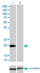 10 - STK32A Antibody (monoclonal) (M01) AT4079a