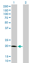 1 - STK32A Antibody (monoclonal) (M01) AT4079a