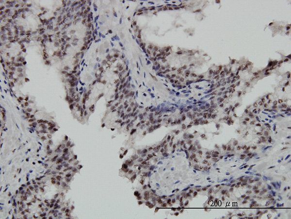 2 - STK32C Antibody (monoclonal) (M02) AT4080a