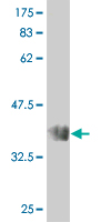 1 - STK32C Antibody (monoclonal) (M02) AT4080a