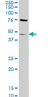 1 - STK32C Antibody (monoclonal) (M02) AT4080a