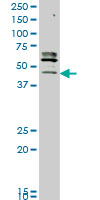 1 - STK32C Antibody (monoclonal) (M05) AT4081a