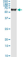 5 - STK33 Antibody (monoclonal) (M03) AT4083a