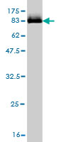 1 - STK33 Antibody (monoclonal) (M09) AT4085a