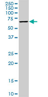 1 - STK33 Antibody (monoclonal) (M09) AT4085a