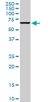 1 - STK33 Antibody (monoclonal) (M09) AT4085a
