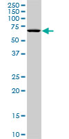 1 - STK33 Antibody (monoclonal) (M09) AT4085a