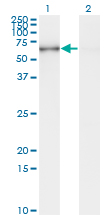1 - STK33 Antibody (monoclonal) (M09) AT4085a