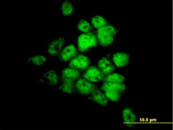 3 - STK33 Antibody (monoclonal) (M09) AT4085a