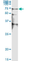 5 - STK38 Antibody (monoclonal) (M01) AT4086a