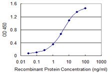 10 - SUOX Antibody (monoclonal) (M01) AT4105a