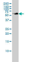 1 - SUOX Antibody (monoclonal) (M01) AT4105a