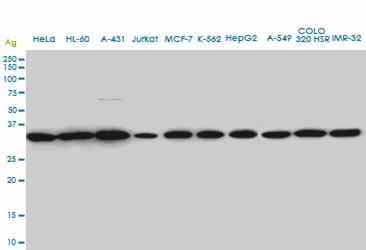 1 - SUPT3H Antibody (monoclonal) (M01A) AT4107a
