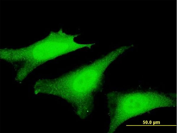 3 - SVIL Antibody (monoclonal) (M03) AT4117a