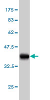 1 - SVIL Antibody (monoclonal) (M03) AT4117a