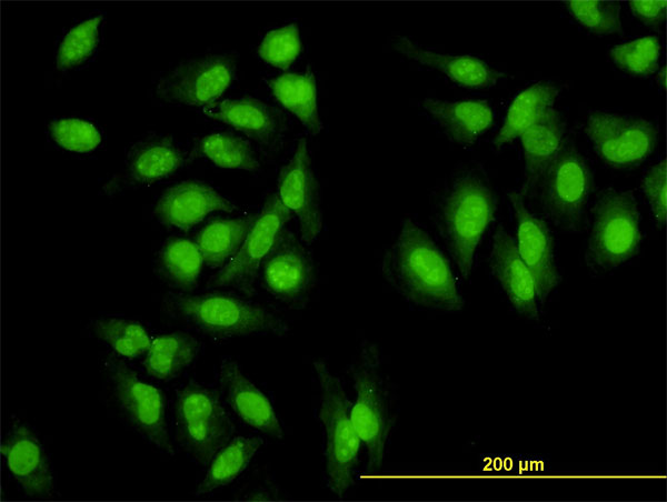 3 - SYMPK Antibody (monoclonal) (M03) AT4118a