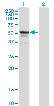 1 - SYMPK Antibody (monoclonal) (M03) AT4118a
