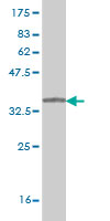 1 - SYNGR2 Antibody (monoclonal) (M01) AT4122a