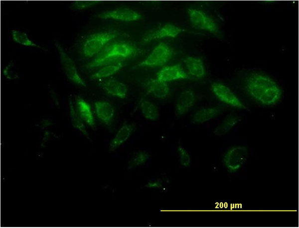 3 - SYT11 Antibody (monoclonal) (M03) AT4127a
