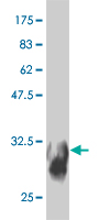1 - SYT11 Antibody (monoclonal) (M03) AT4127a
