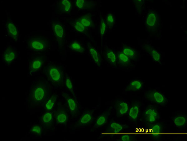 3 - TAF11 Antibody (monoclonal) (M01) AT4138a