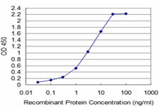10 - TAF11 Antibody (monoclonal) (M03) AT4139a