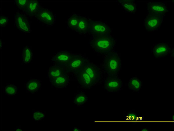 3 - TAF11 Antibody (monoclonal) (M03) AT4139a