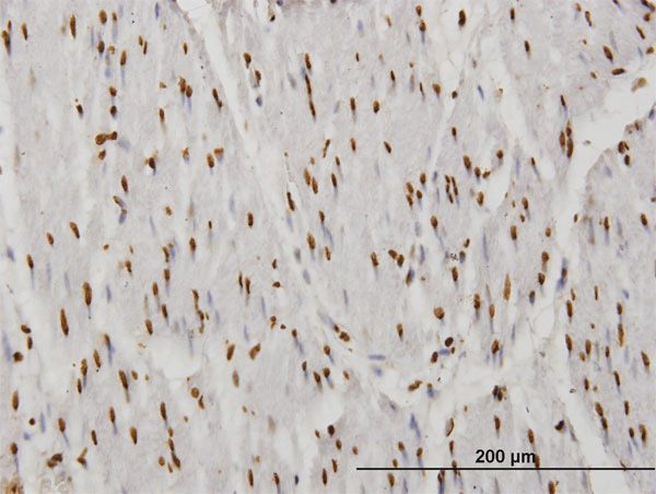 2 - TAF11 Antibody (monoclonal) (M03) AT4139a