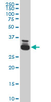 1 - TAF11 Antibody (monoclonal) (M03) AT4139a