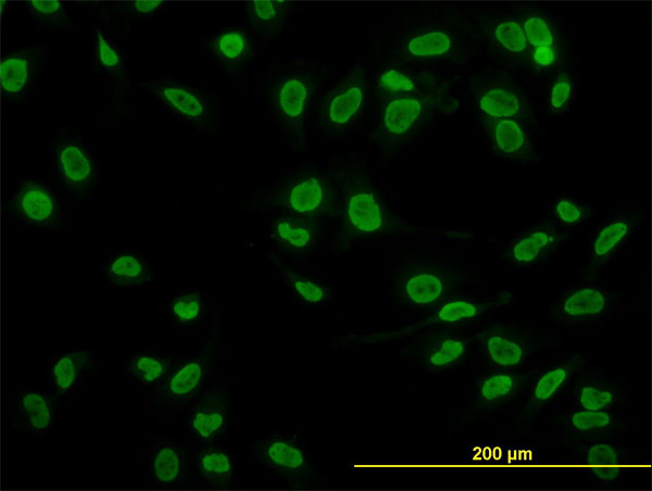 3 - TAF11 Antibody (monoclonal) (M04) AT4140a