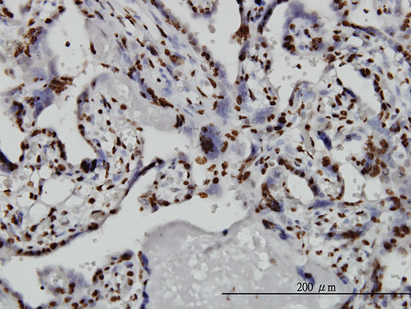2 - TAF11 Antibody (monoclonal) (M04) AT4140a