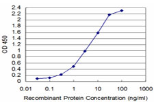 10 - TAF11 Antibody (monoclonal) (M06) AT4141a