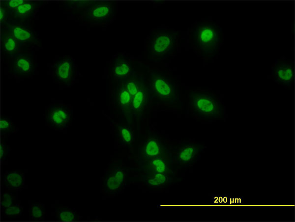 3 - TAF11 Antibody (monoclonal) (M06) AT4141a