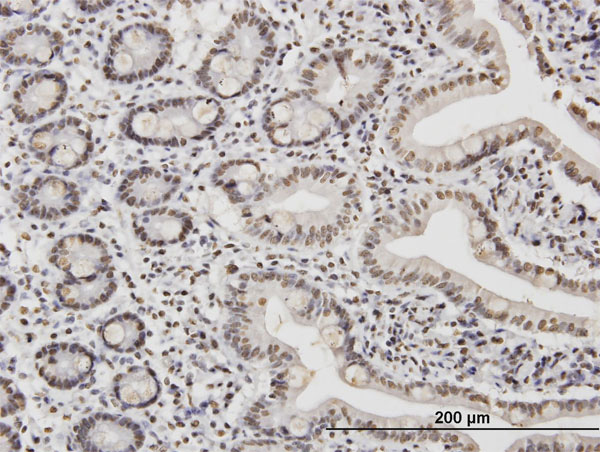 2 - TAF11 Antibody (monoclonal) (M06) AT4141a
