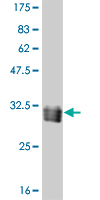 1 - TAF11 Antibody (monoclonal) (M06) AT4141a