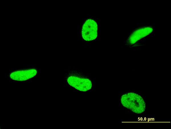 3 - TAF12 Antibody (monoclonal) (M11) AT4142a
