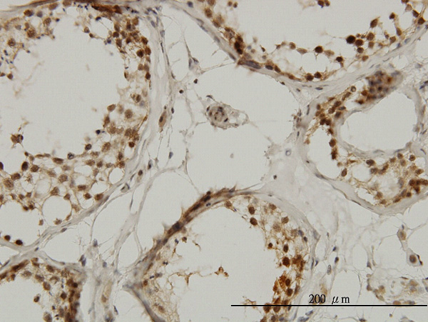 2 - TAF1L Antibody (monoclonal) (M01) AT4145a
