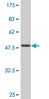 1 - TAGLN Antibody (monoclonal) (M01) AT4149a