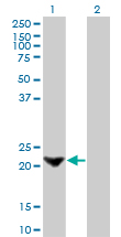 1 - TAGLN Antibody (monoclonal) (M01) AT4149a