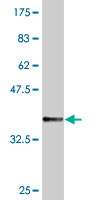 1 - TAPBPL Antibody (monoclonal) (M02) AT4151a