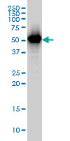 1 - TAPBPL Antibody (monoclonal) (M02) AT4151a