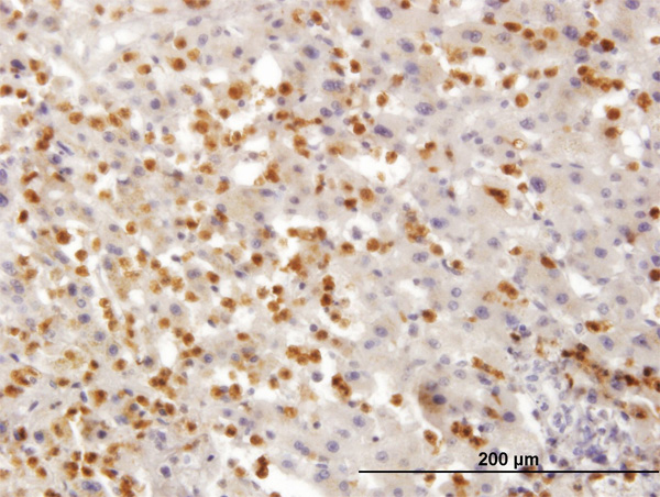 2 - TARS Antibody (monoclonal) (M01) AT4155a