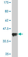 1 - TARS Antibody (monoclonal) (M01) AT4155a