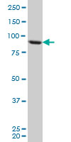 1 - TARS Antibody (monoclonal) (M01) AT4155a