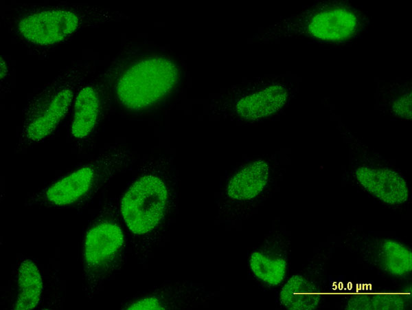 3 - TBX18 Antibody (monoclonal) (M06) AT4165a