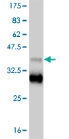 1 - TBX18 Antibody (monoclonal) (M06) AT4165a