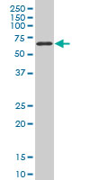 1 - TBX18 Antibody (monoclonal) (M06) AT4165a