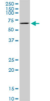 1 - TBX18 Antibody (monoclonal) (M06) AT4165a