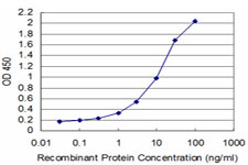 10 - TCEA3 Antibody (monoclonal) (M07) AT4176a