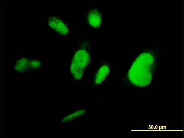 3 - TCEA3 Antibody (monoclonal) (M07) AT4176a